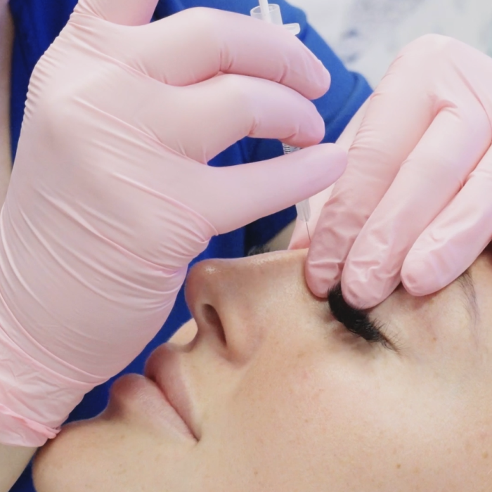 non surgical rhinoplasty in cypress tx